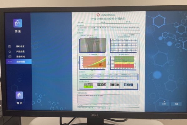 骨密度低怎么辦？養(yǎng)成良好生活習(xí)慣，從多方面增強(qiáng)骨密度